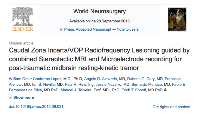 Caudal Zona Incerta/VOP Radiofrequency Lesioning guided by combined Stereotactic MRI and Microelectrode recording for post-traumatic midbrain resting-kinetic tremor