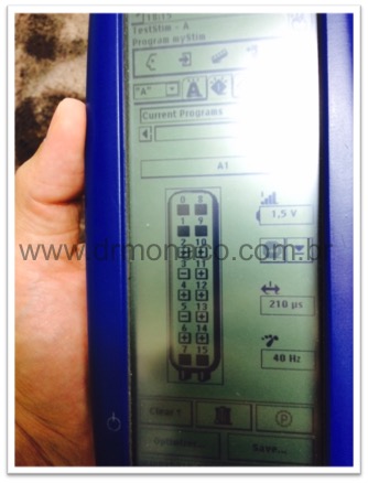 Baclofeno Mais Barato